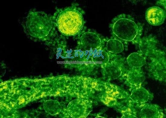 在特效药出现前，抵抗新型冠状病毒更多的是依靠自身免疫力