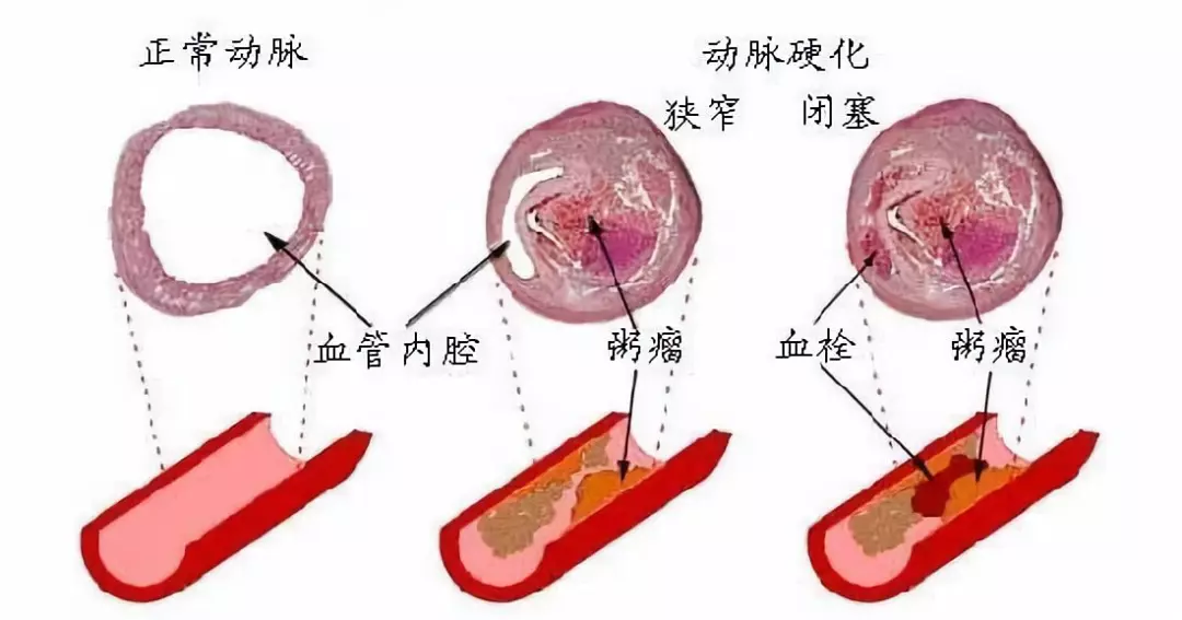 春季服用灵芝孢子粉，双向调节身体机能
